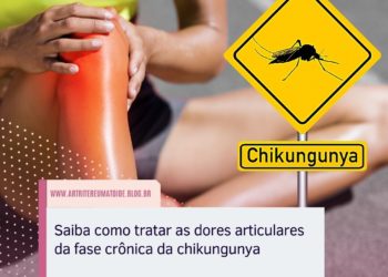 Saiba como tratar as dores articulares da fase crônica da chikungunya