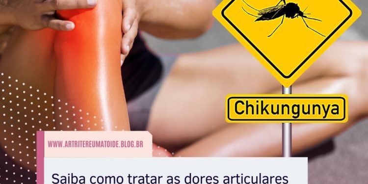 Saiba como tratar as dores articulares da fase crônica da chikungunya