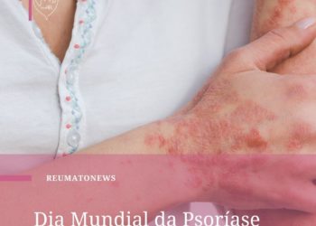 Dia Mundial da Psoríase – Bahiana Saúde