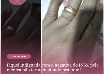 Fiquei indignada com a negativa do INSS, pela médica não ter nem olhado pra mim!