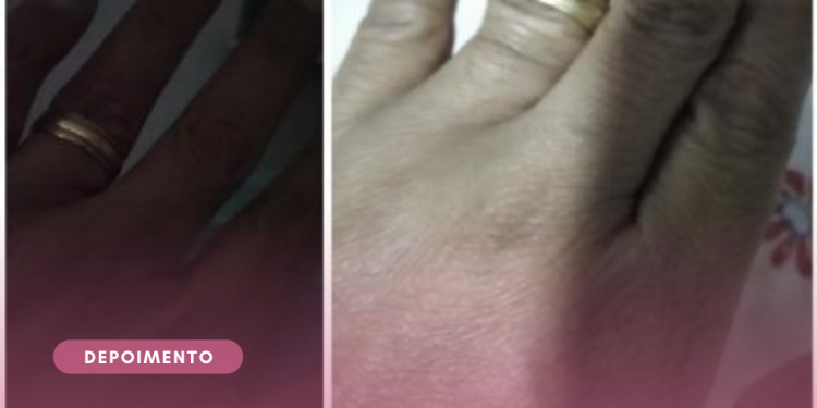 Fiquei indignada com a negativa do INSS, pela médica não ter nem olhado pra mim!