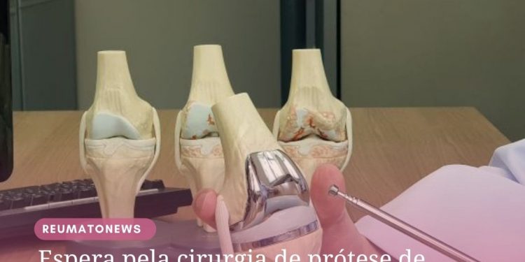 Espera pela cirurgia de prótese de joelho e quadril reduz qualidade de vida dos pacientes na pandemia, aponta estudo