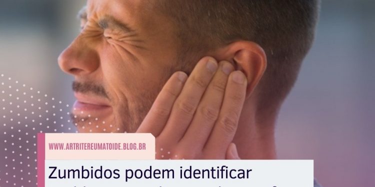 Zumbidos podem identificar problemas cardiovasculares, afirma especialista