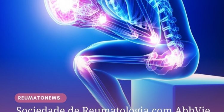Sociedade de Reumatologia com AbbVie, Janssen, GSK, Novartis e Pfizer começa campanha de atenção as doenças reumáticas