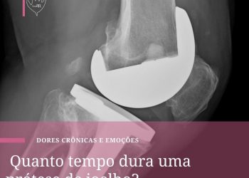 Quando tempo dura uma prótese de joelho?