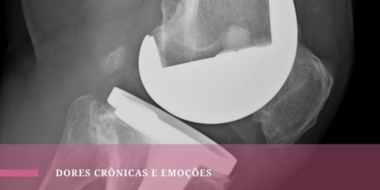 Quando tempo dura uma prótese de joelho?