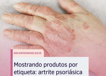 Mostrando produtos por etiqueta: artrite psoriásica