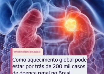 Como aquecimento global pode estar por trás de 200 mil casos de doença renal no Brasil