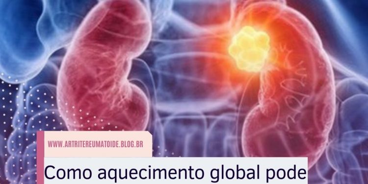 Como aquecimento global pode estar por trás de 200 mil casos de doença renal no Brasil