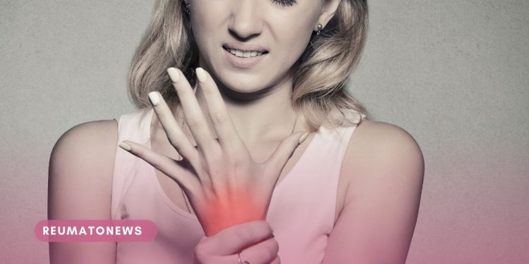 Quando procurar um reumatologista?