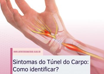 Sintomas do Túnel do Carpo: Como identificar?