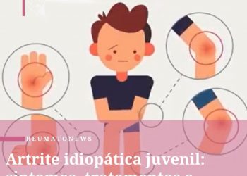 Artrite idiopática juvenil: sintomas, tratamentos e causas
