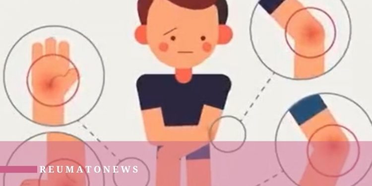 Artrite idiopática juvenil: sintomas, tratamentos e causas