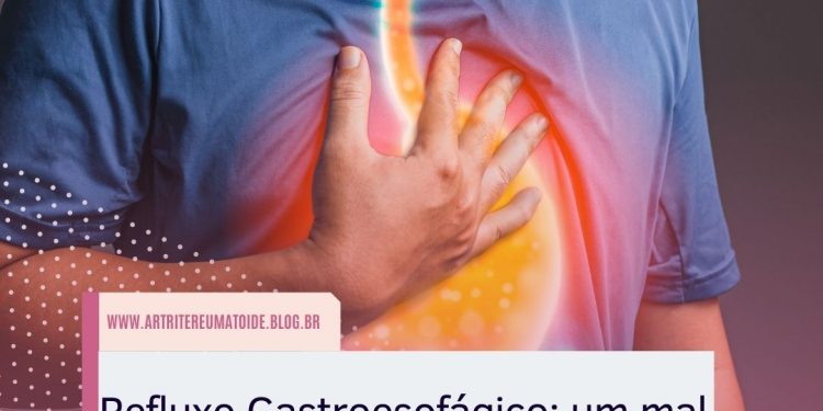 Refluxo Gastroesofágico: um mal mais comum do que imaginamos
