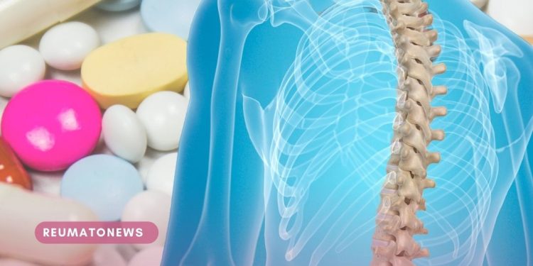 Você sabia que os anti-inflamatórios podem causar danos à coluna?