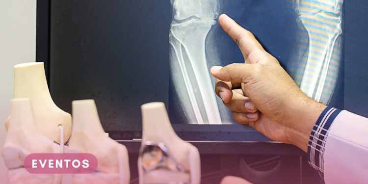 FGV EAESP realiza seminário online sobre políticas públicas para o enfrentamento da osteoporose no Brasil