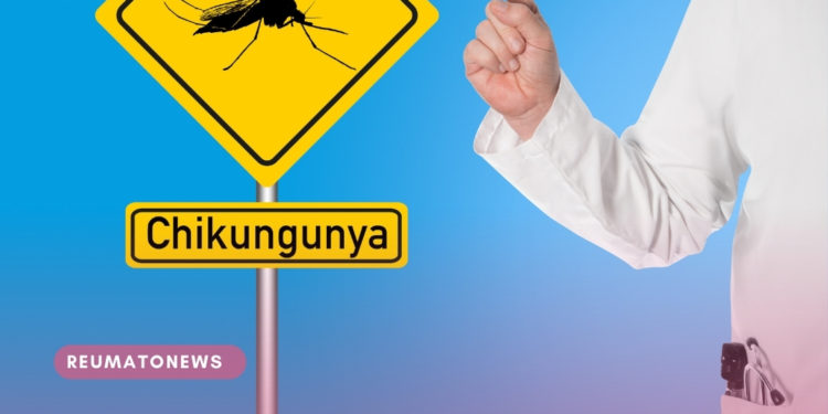 Dores da chikungunya podem persistir por anos