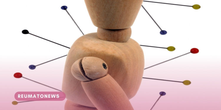 Veja 7 benefícios da acupuntura para a saúde; técnica é reconhecida como terapia integrativa no SUS