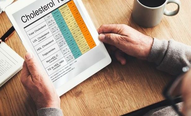 Como é feito o exame de colesterol e quando realizá-lo?