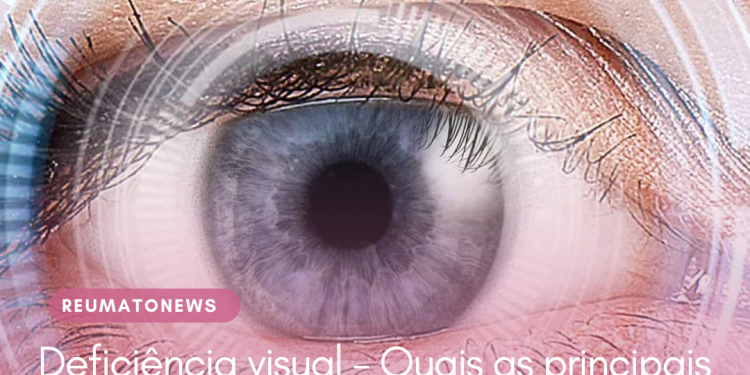 Deficiência visual – Quais as principais causas da perda de visão e como prevenir?