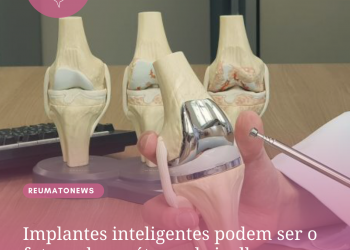 Implantes inteligentes podem ser o futuro das próteses de joelho