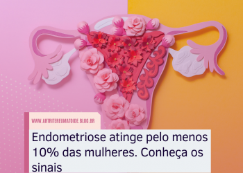 Endometriose atinge pelo menos 10% das mulheres. Conheça os sinais