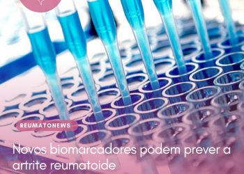 Novos biomarcadores podem prever a artrite reumatoide