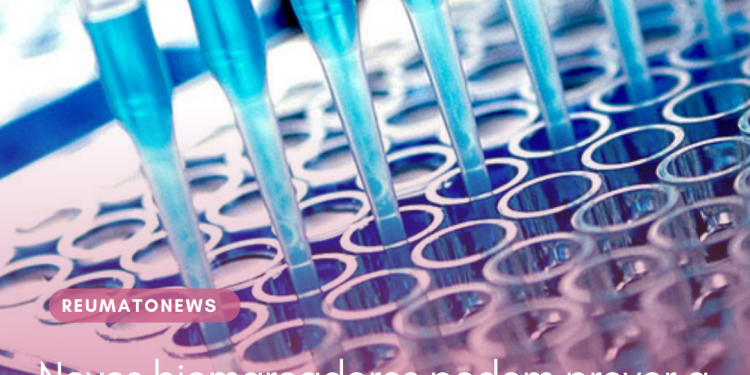 Novos biomarcadores podem prever a artrite reumatoide