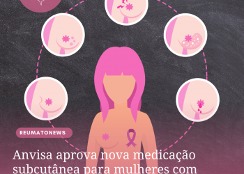 Anvisa aprova nova medicação subcutânea para mulheres com câncer de mama
