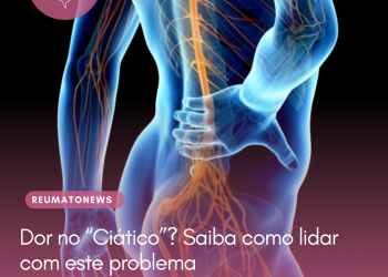 Dor no “Ciático”? Saiba como lidar com este problema