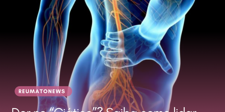 Dor no “Ciático”? Saiba como lidar com este problema