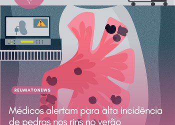 Médicos alertam para alta incidência de pedras nos rins no verão