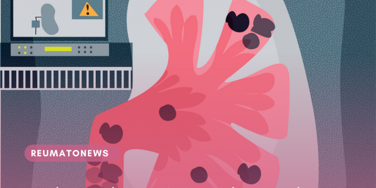 Médicos alertam para alta incidência de pedras nos rins no verão