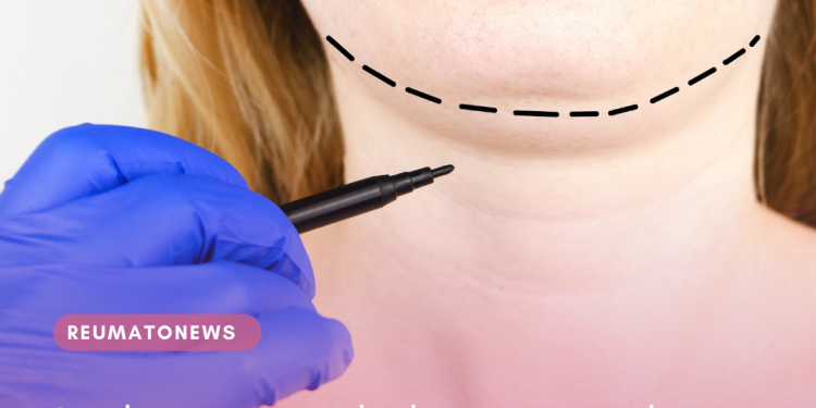 Conheça os cuidados que envolvem a cirurgia plástica da papada