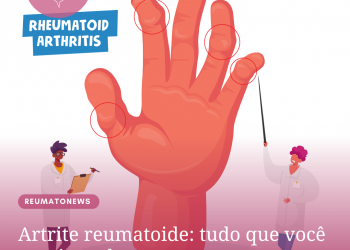 Artrite reumatoide: tudo que você precisa saber