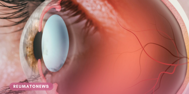 Estudo aponta que 20,2% das pessoas com diabetes no Brasil têm retinopatia, condição que pode levar à cegueira