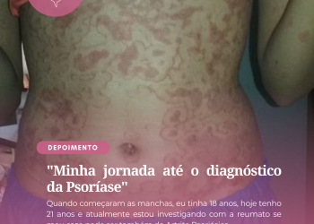 Minha jornada até o diagnóstico da Psoríase