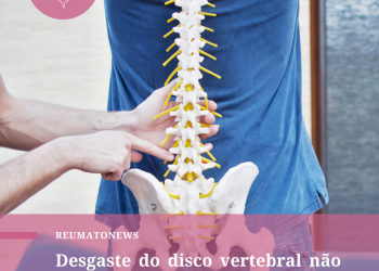 Desgaste do disco vertebral não é sinônimo de doença