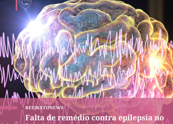 Na falta de remédio para epilepsia, Ministério da Saúde propõe reduzir dosagem