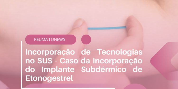 Incorporação de Tecnologias no SUS – Caso da Incorporação do Implante Subdérmico de Etonogestrel