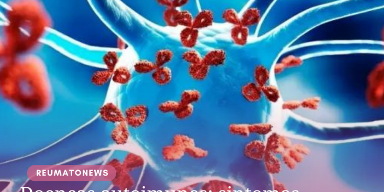 Doenças autoimunes: sintomas comuns a outras patologias atrasam diagnóstico