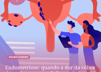 Endometriose: quando a dor da cólica deve chamar atenção?