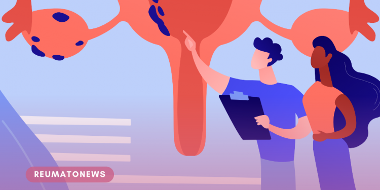 Endometriose: quando a dor da cólica deve chamar atenção?