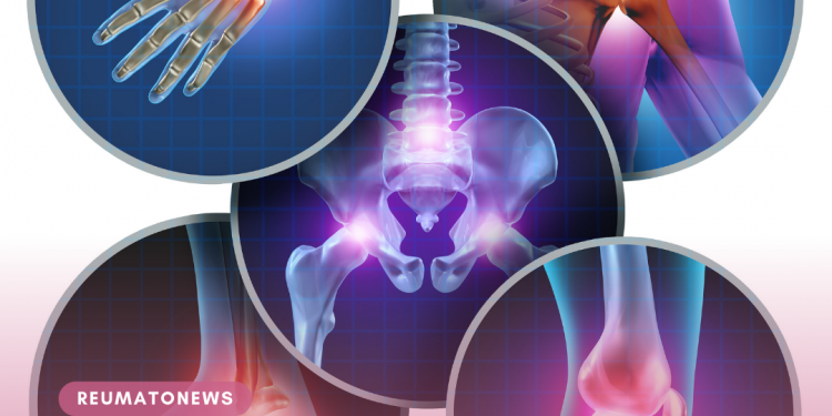 Dor nas articulações? Ortopedista revela 6 mitos sobre a artrose