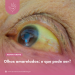 Olhos amarelados: o que pode ser?