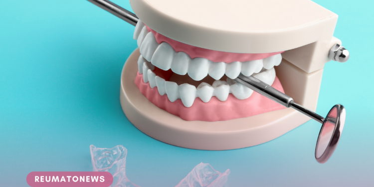 Você Conhece o Que é Bruxismo? Saiba Tudo Sobre Esse Problema