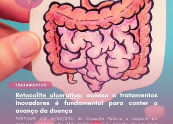 Retocolite ulcerativa: acesso a tratamentos inovadores é fundamental para conter o avanço da doença