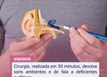 Cirurgia, realizada em 30 minutos, devolve sons ambientes e de fala a deficientes auditivos