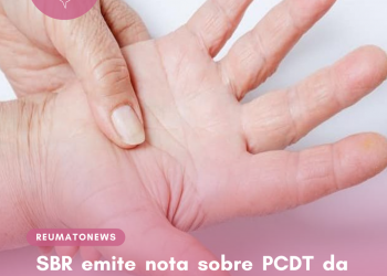 SBR emite nota sobre PCDT da Esclerose sistêmica