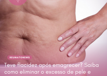 Teve flacidez após emagrecer? Saiba como eliminar o excesso de pele e recuperar a autoestima